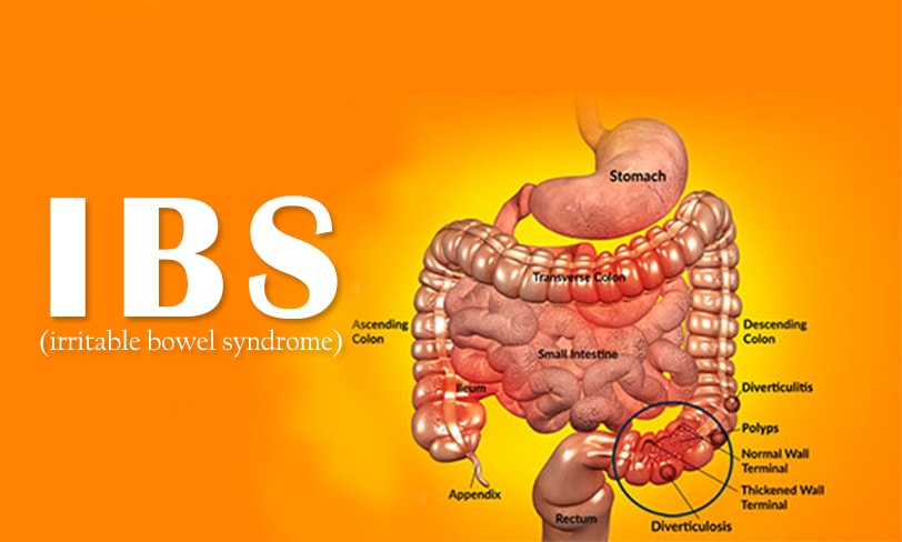 IBS-Medicine1